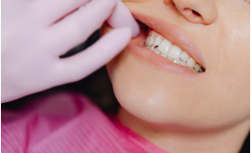 Denti sensibili? cause, rimedi e prodotti consigliati