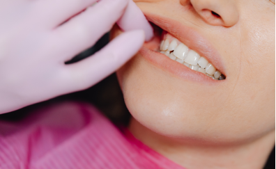 Denti sensibili? cause, rimedi e prodotti consigliati Denti sensibili? cause, rimedi e prodotti consigliati